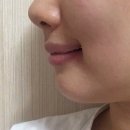 틀니쟁이 이미지