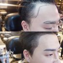 매직헤어라인 이미지