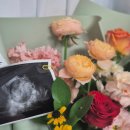 광명시보건소 | 광명시 보건소 임산부 등록 혜택 임산부 뱃지 수령