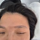 운정일번약국 | 파주 운정 실패한 눈썹잔흔제거 마가제이 뷰티 내돈내산 1차 후기