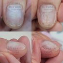 네일샵 | 선정릉 네일, 손톱 물어뜯기 교정 네일샵 후기