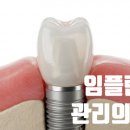 대신치과기공소 | 하단예방치과 | 임플란트, “심고 끝”이 아니라 ‘관리’의 시작입니다 — 치가(家)예방 관점 가이드