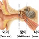 샘보청기 이미지