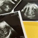 w-37 | [임신기록]37w3d/37주/초산모유도분만/머리큰아기/유도분만예정