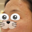 잠실예쁨주의쁨의원 | [피부관리] 프리미엄 물광주사 릴리이드M 5ml 손주사 내돈내산 후기(Feat.잠실 쁨의원)