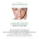 한서자기한의원 | 천안실리프팅 매선침을이용하여 안심할수있는 한방시술