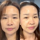 산본 에스테티아에서 슬로우에이징 스피큘루션Q 피부관리 받은 솔직후기