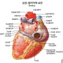 심근경색(心筋梗塞) 5대 원인(原因) 뿌리 뽑는 법 이미지