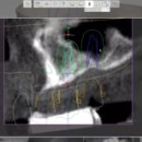 이엘치과기공소 이미지