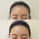 뷰티헤어라인 이미지