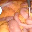디자인더바디 네이버블로그