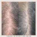 영앤유
