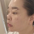 충주충전소 | [충주 피부관리 후기] 서충주 앤뷰티 VVS 무결점 관리 – 극건성 맞춤 수분케어 &amp; 웨딩관리 전문