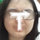 두앤통신경과의원 | [후기] 영등포 유앤아이 - 올포유 상담 + 1회차 + 2회...후기 (a.k.a 피부과알못인 내가 경과 보려고...