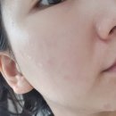 하나메드라인 이미지