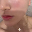 더한의원 | 부산여드름 치료 피부관리한의원 &#34;PN리빌더 T&#34; 후기