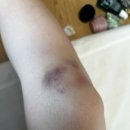 달빛조은펜션 | 바다는 양양! 양양은 서핑! 양양 근데 다 죽음... 우리밖에없다... 바다 전세낸 후기 -2