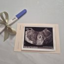 주식회사 레피리움시그니처 산후조리원 다산점 | 남양주 다산 산후조리원 레피리움시그니처 다산점 예약 후기