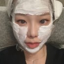 순백피부과 | 잠실새내역 피부과 순백주사 스킨보톡스 후기 가격 효과 통증 부작용