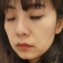본태의원 네이버블로그