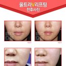 멍메이드 이미지