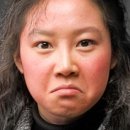 홍조