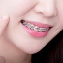 아삭플란트치과의원