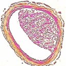 Re: 활성산소, Nitro oxidative stress 바이오 마커.... 이미지