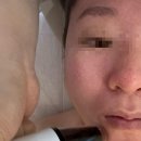 노노메디칼 | 수지 피부관리 추천｜모공부터 피부결까지 관리한 플라즈마 후기