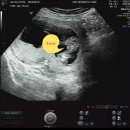 인생카서비스 이미지