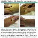 순천시 유용미생물 생산시설 | 전신경화증/경피증의 최신지견으로 살펴보는 원인,치료,한계점(Feat. 면역 관용 회복)