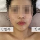 루시엘라 | 영등포피부관리 신도림에스테틱 루시엘라 얼굴축소 후기
