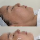 유포리아 | 청량리 피부관리 유포리아 관리 후기