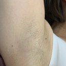용인왁싱 더스무스죽전역점에서 에스테틱 피부관리까지 받아보세요! ^^