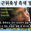 족하수 원인과 치료 방법 - 사암오행침, 사암침법, 오행침, 정통사암침 이미지