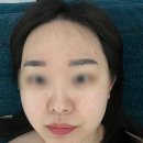 울산 피부관리 제이콤마 피부앤 왁싱 후기, 피부관리는 제이콤마에서 !