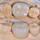 박영준치과의원 | [공지] 박영준치과, 15년 경력의 치과의사의 진료철학 3가지