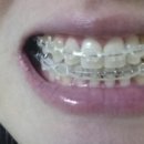 클래스원치과의원 이미지