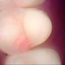 남산치과의원 네이버블로그