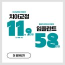 동일치과의원 | 대전치아교정 통증과 불편함을 줄인 둔산동 서울브라운치과