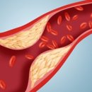 올데이피티 이미지