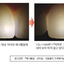 나노치과의원 이미지