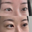 인블리 | 원주 무실동 속눈썹 펌 추천 “ 인블리뷰티 ” 후기
