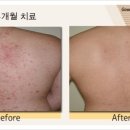 제성한의원 이미지