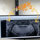 [일상] 턱관절 제발 빨리 치료해! 의정부 TMD 턱관절 치료 후기(+5개월차)