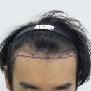 압구정맘모스헤어라인의원 이미지