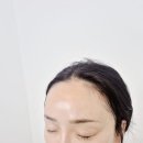 성신여대두피관리 바이로마드 후기 스트레스성 탈모, 정밀 진단부터 가성비 관리까지