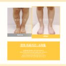 수한의원 | 자반증 한의원, 치료 후기만 보고 갔다가 100% 후회합니다.