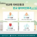 소리코이비인후과 네이버블로그