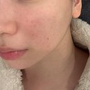 이리산소 | 검단피부관리 아라역 유어스킨웰 시그니처 케어 솔직후기 (붉은기 진정 효과 좋았던 곳)